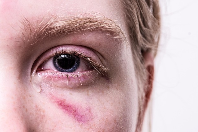 Recognising and treating trauma - crying person with a blue eye - symbol of childhood trauma, emotional injuries and psychological wounds from childhood